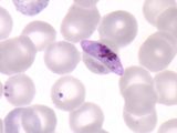 Paludisme ou malaria…that’s the question