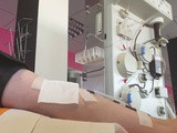 Jour 9 – « Pourquoi t’as un plâtre ? »